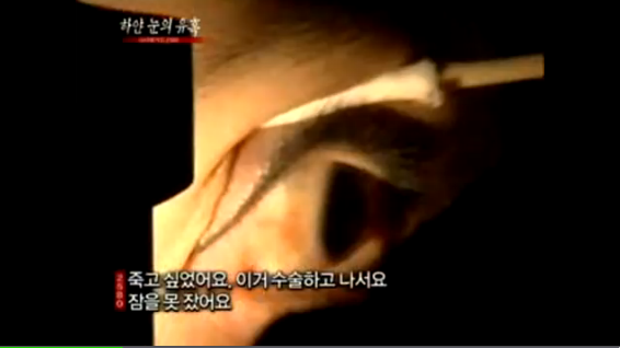 2011년에 퇴출된 성형수술 | 인스티즈