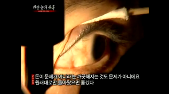 2011년에 퇴출된 성형수술 | 인스티즈
