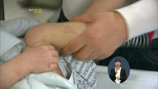 [60분부모] 아토피가 아이의 자존감을 낮춘다 ① | 인스티즈