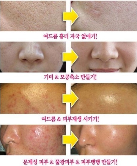 르네셀 이미지