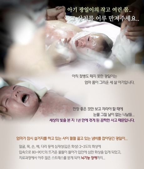 광일 이미지