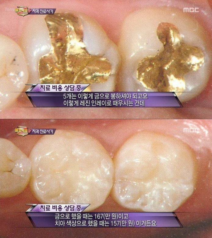 치과 치료의 진실 | 인스티즈