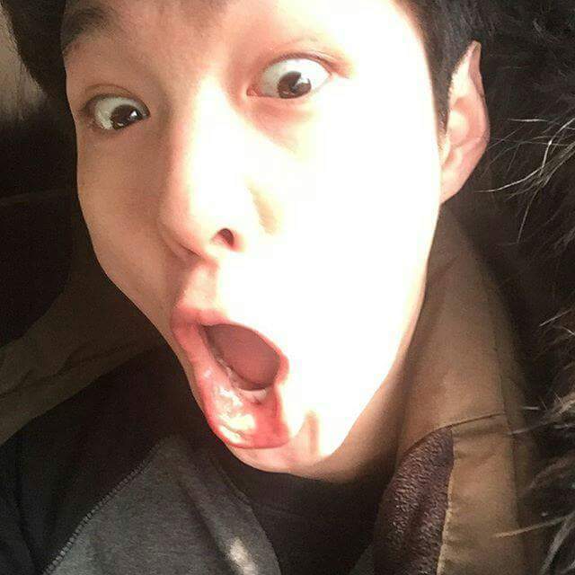 은광 이미지