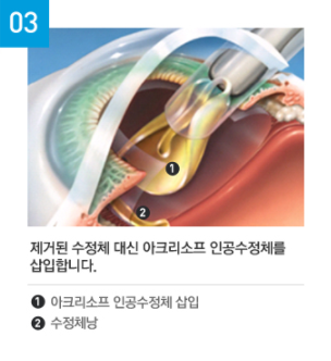 광주안과의원 이미지