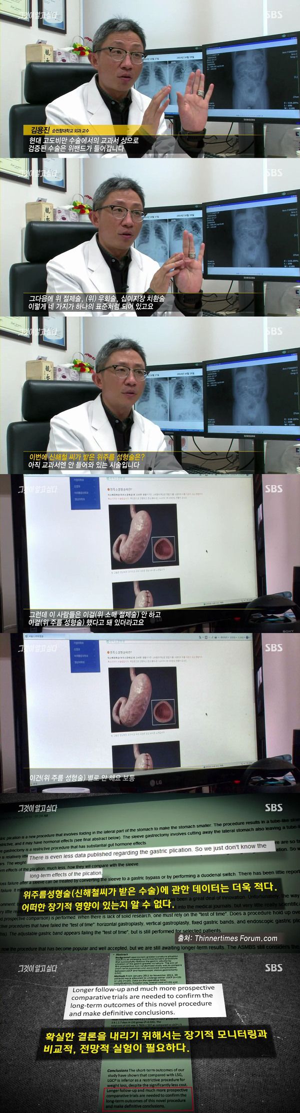 [그것이알고싶다] 할인으로 광고하고 그 할인비 보험으로 받아내려 환자 맹장 담낭 맘대로 떼어내는 의사 (신해철 외) | 인스티즈