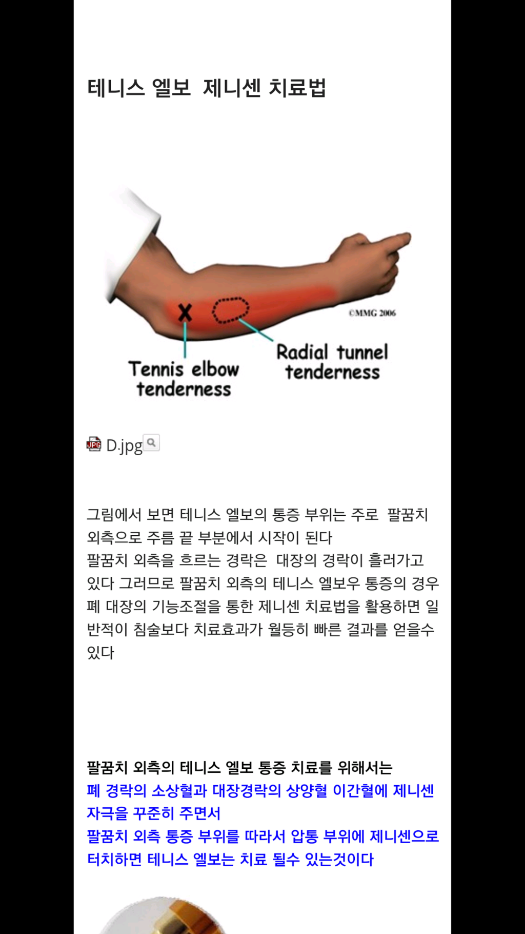 제니센 덤으로 선물받은 기분입니다. - ▣ 국내 제니센 치료사례 - 건강한 삶을 열어가는 힐링라이프 건강한 삶을 열어가는 힐링라이프