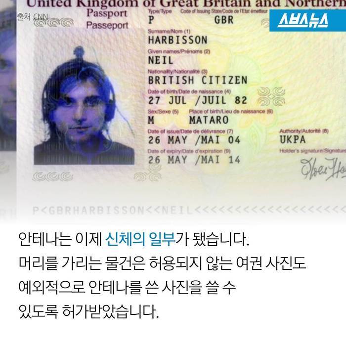  스스로 사이보그가 된 남자 | 인스티즈