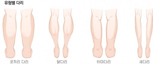 퉁퉁 부은 무다리 탈출법 꿀팁.jpg | 인스티즈