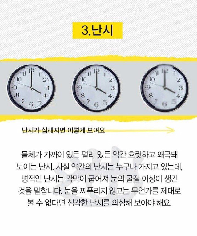 눈으로 알 수 있는 질병 | 인스티즈