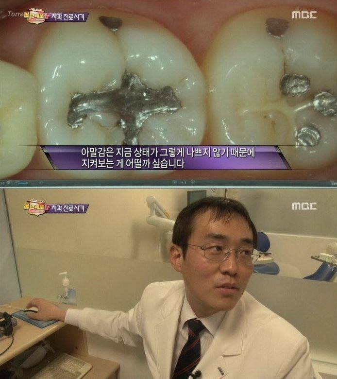 치과 치료의 진실 | 인스티즈