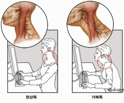 몸살림체형수기 이미지