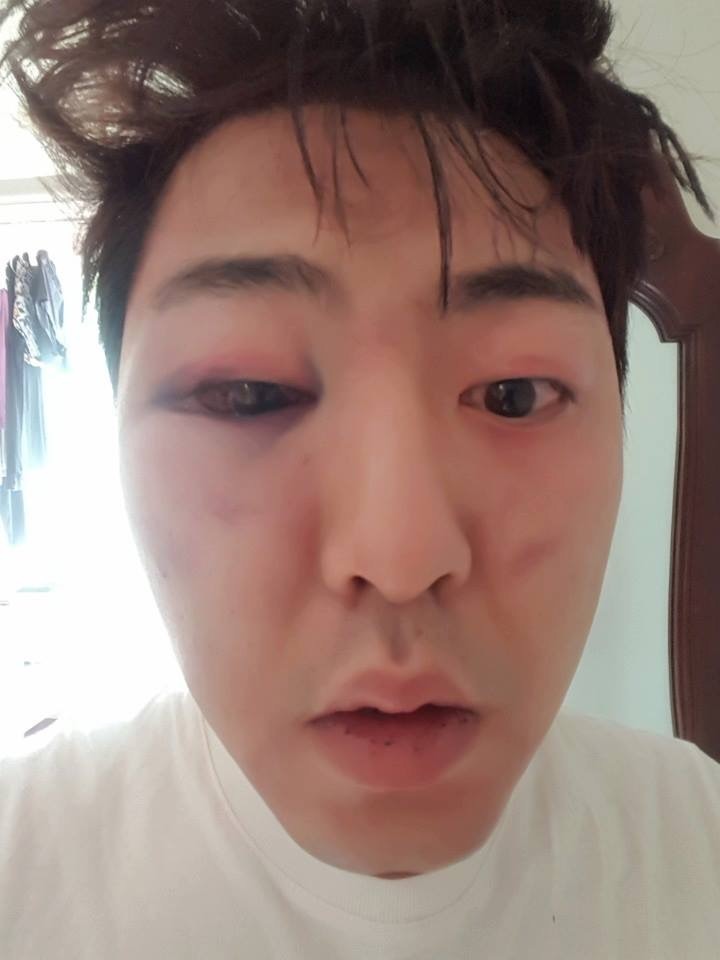 보이스피싱 용의자로 오인하고 일반인 폭행한 경찰들 (피해자분 사진 있음) | 인스티즈