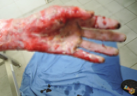 안녕하세요 저는 자주포사고 부상자 이찬호입니다. (사진 꼭 주의하고 들어와) | 인스티즈