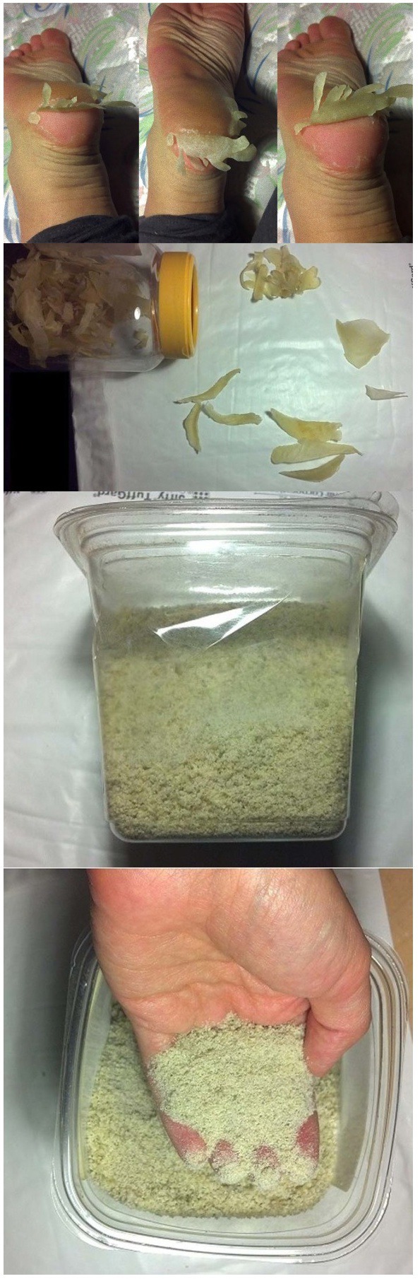 굳은살 레전드 | 인스티즈