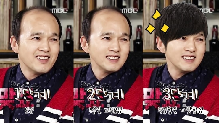 머리숱의 중요성 | 인스티즈