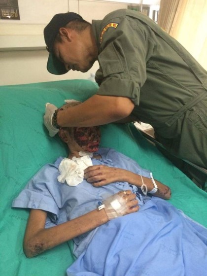 약물 알레르기로 인해 피해받는 사람(혐오주의) | 인스티즈