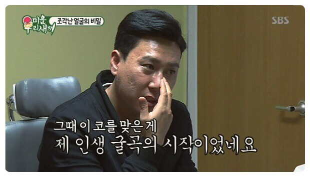 이상민 얼굴에 박혀있는 수많은 나사 | 인스티즈